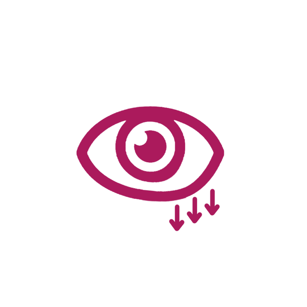 eyebag5